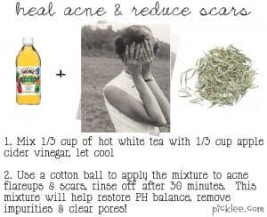 heal acne and reduce scars