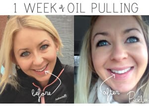 benefits of oil pulling white teeth1