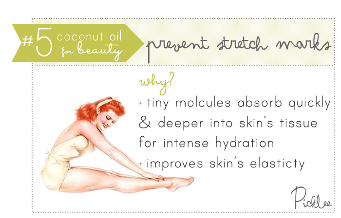 coconut oil uses-prevent stretch marks